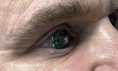 Mojo Vision״βmicro LEDӵ[R